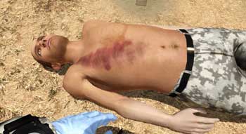 Combat Medic Pneumo Casualty